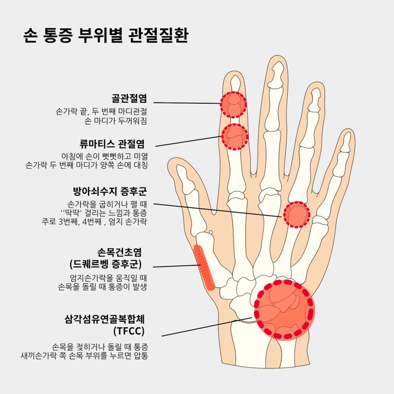 사진=연세스타병원