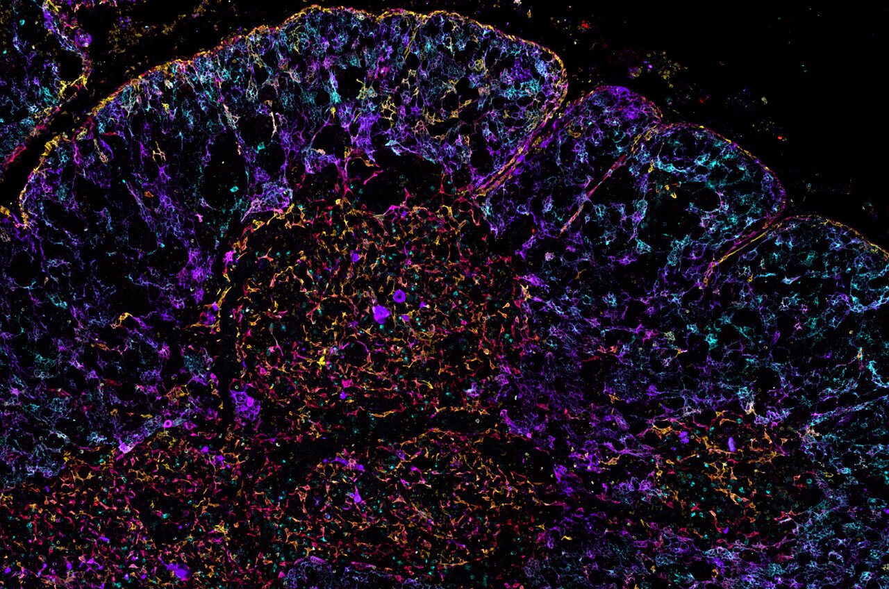 Map of human thymus sheds light - AA1urkKR.img