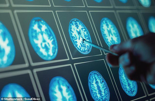 Experts have identified that levels of 13 proteins linked to brain aging spike at 57, 70 and 78