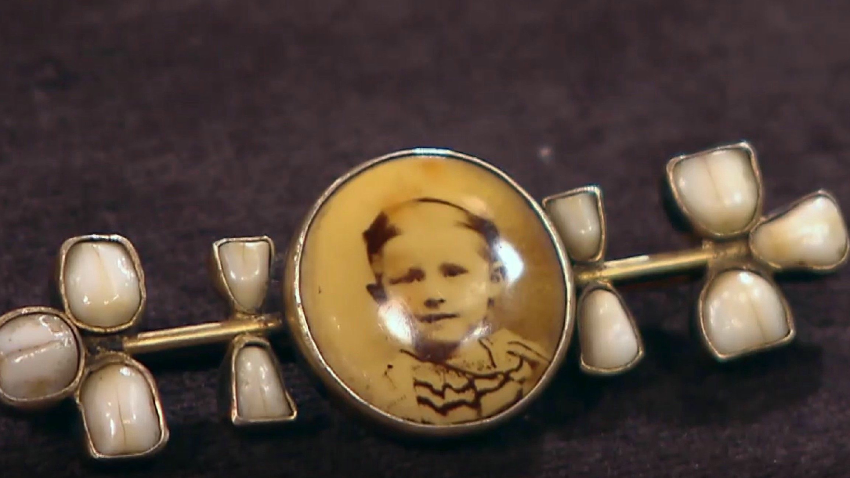 Bares für Rares-Vorschau: Skurril! Zwillinge wollen Zähne der Oma verkaufen