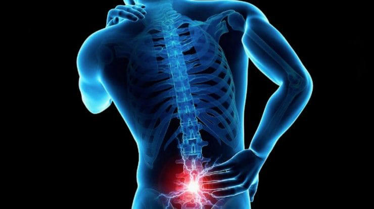 Lumbalgia: el dolor de espalda que va más allá de cargar cosas pesadas