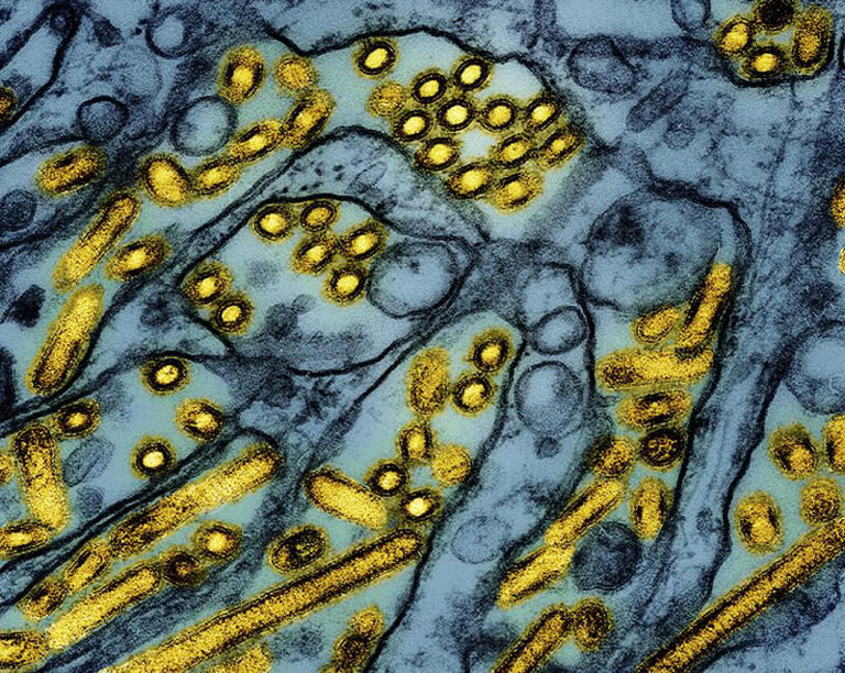 Louisiana Patient Has First Severe Bird Flu Case In Us: Health Officials