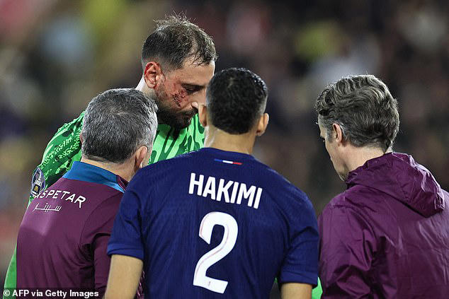 PSG goalkeeper Gianluigi Donnarumma suffers serious facial injury ...