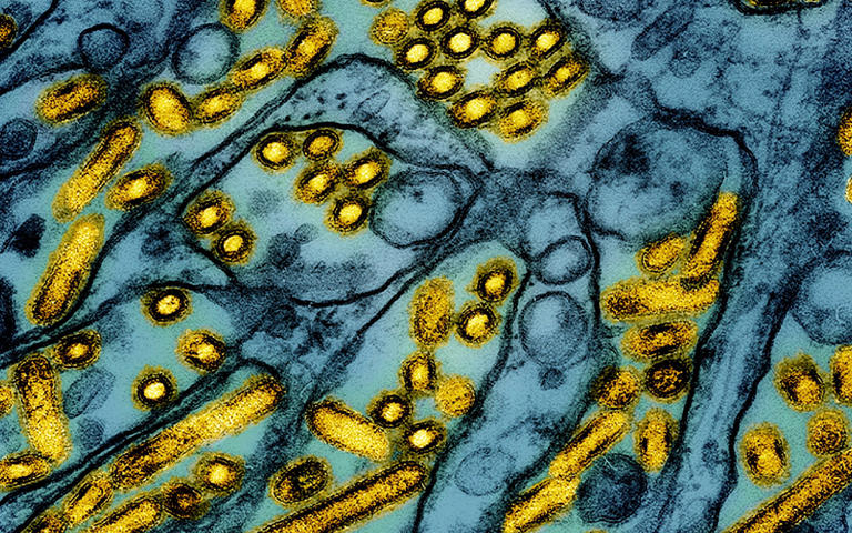 H5N1 avian flu virus particles, in yellow, highlighted by the National Institute of Allergy and Infectious Diseases - CDC/NIAID via AP