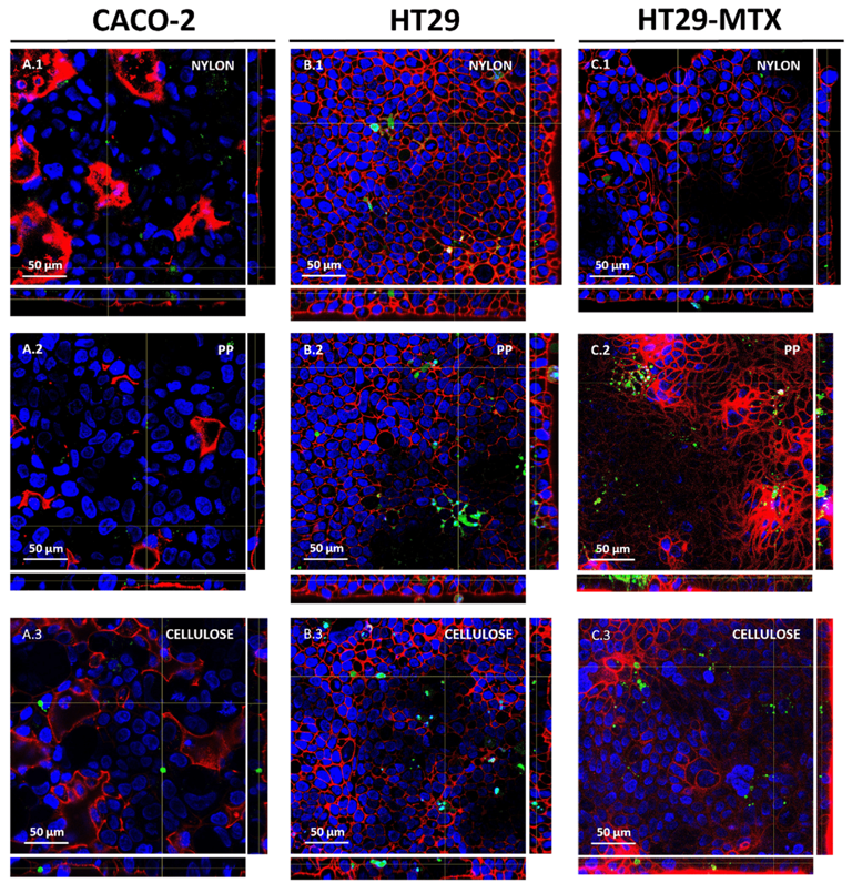 Confocal images of gut-derived cells exposed to fluorescently stained (iDye Poly-pink) teabags-derived MNPLs for 24 h. (CREDIT: Chemosphere)