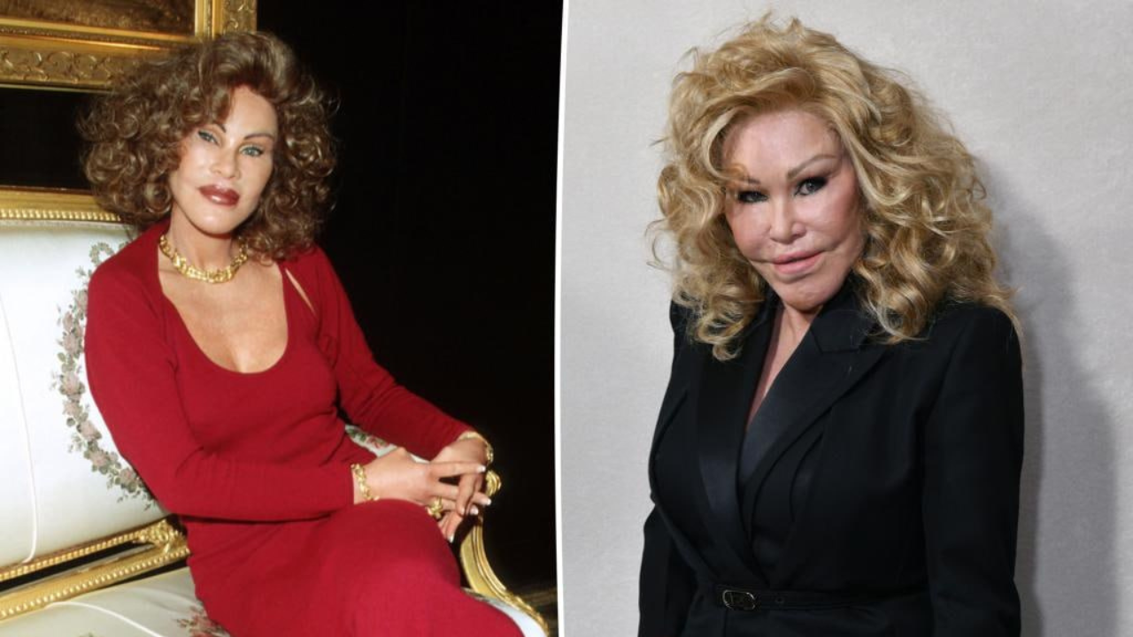 Photos Of 'Catwoman' Jocelyn Wildenstein Before Plastic Surgery Go