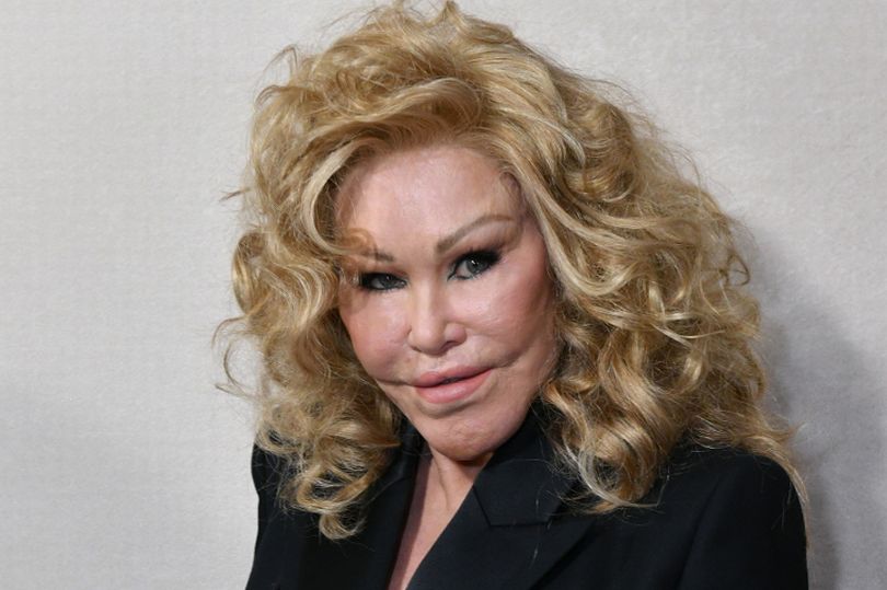 'Catwoman' Jocelyn Wildenstein's real face before major plastic
