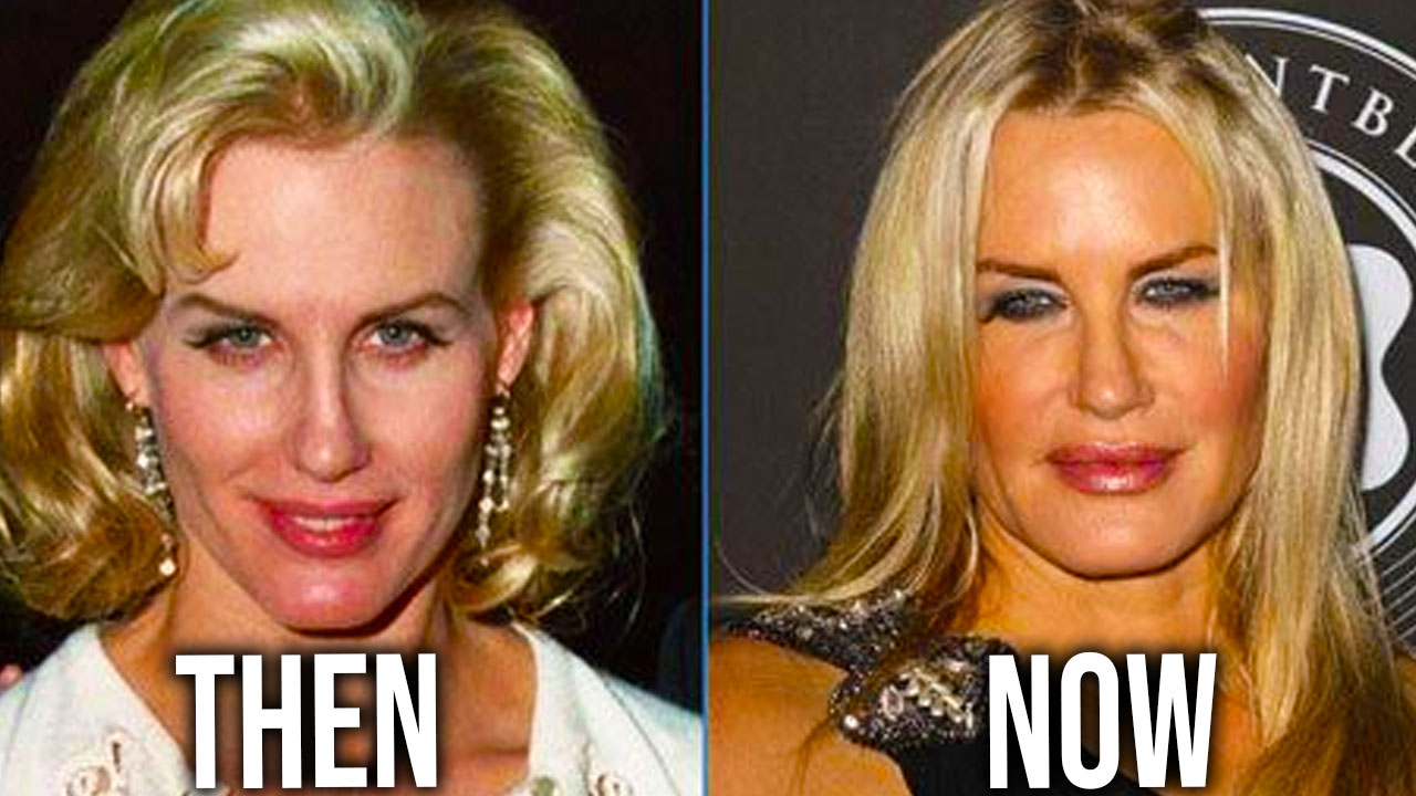 10 celebrities with disastrous plastic surgery