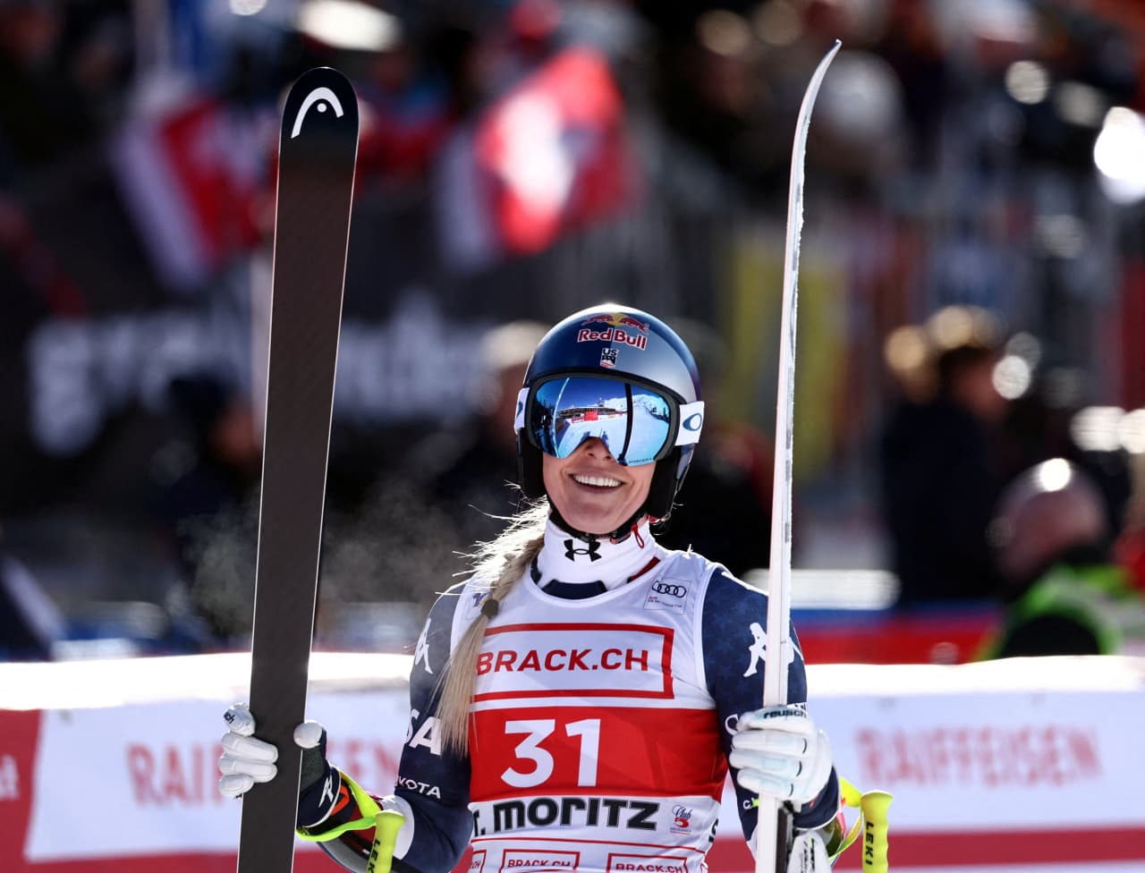 Lindsey Vonn Got A Knee Replacement. Can She Get To The Olympics?