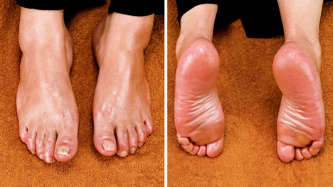 Keep Your Feet Healthy With Pedicures