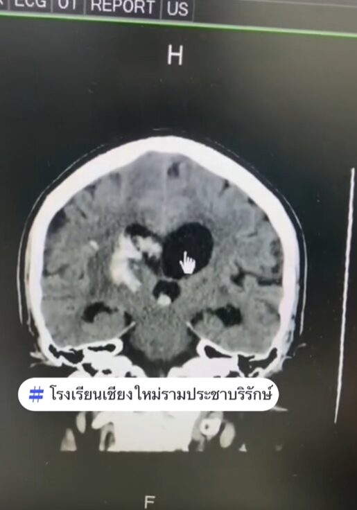 ภาพประกอบข่าว