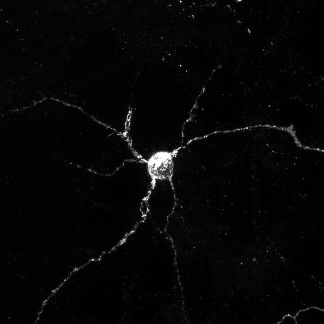 Neuron expressing Aplp1 (in white), which allows brain cells to absorb proteins associated with Parkinson's disease. (Yasuyoshi Kimura)