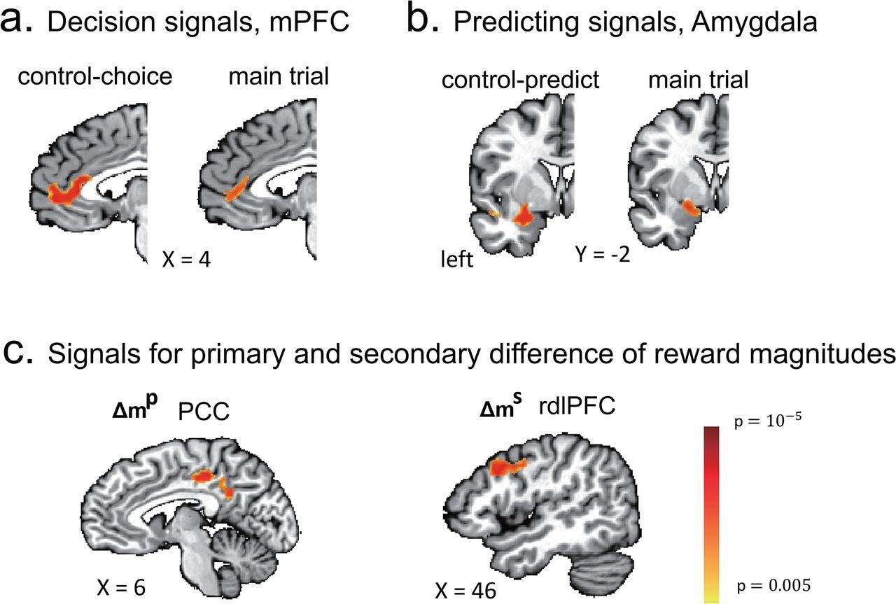 Brain imaging experiments reveal - AA1y8GLf.img