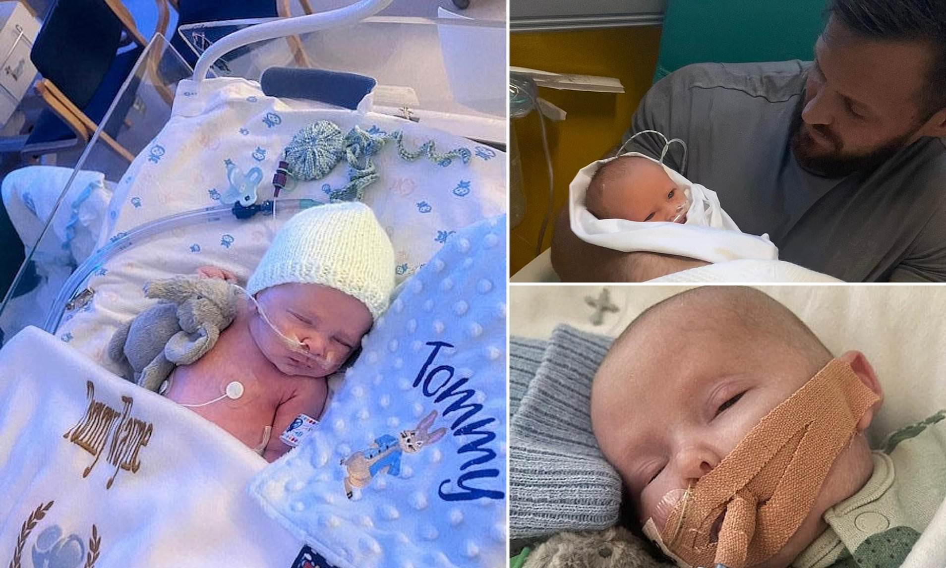 Baby is one of just 23 in the the world with rare disease(02)