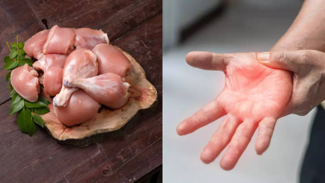 https://www.msn.com/en-au/health/health-news/can-raw-chicken-give-you-paralysis-here-s-how-guillain-barre-syndrome-gets-triggered/ar-AA1yTvxr