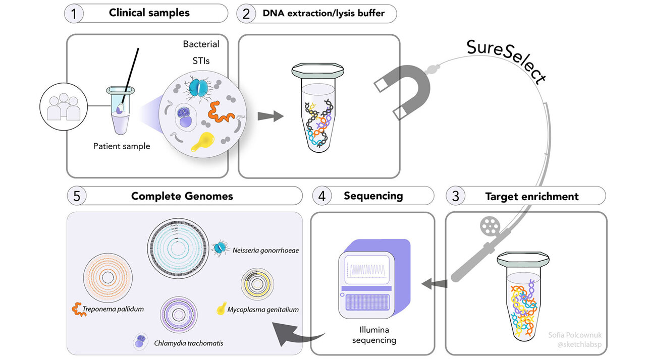 Advanced DNA technique reveals hidden Chlamydia lineage, aiding STI control