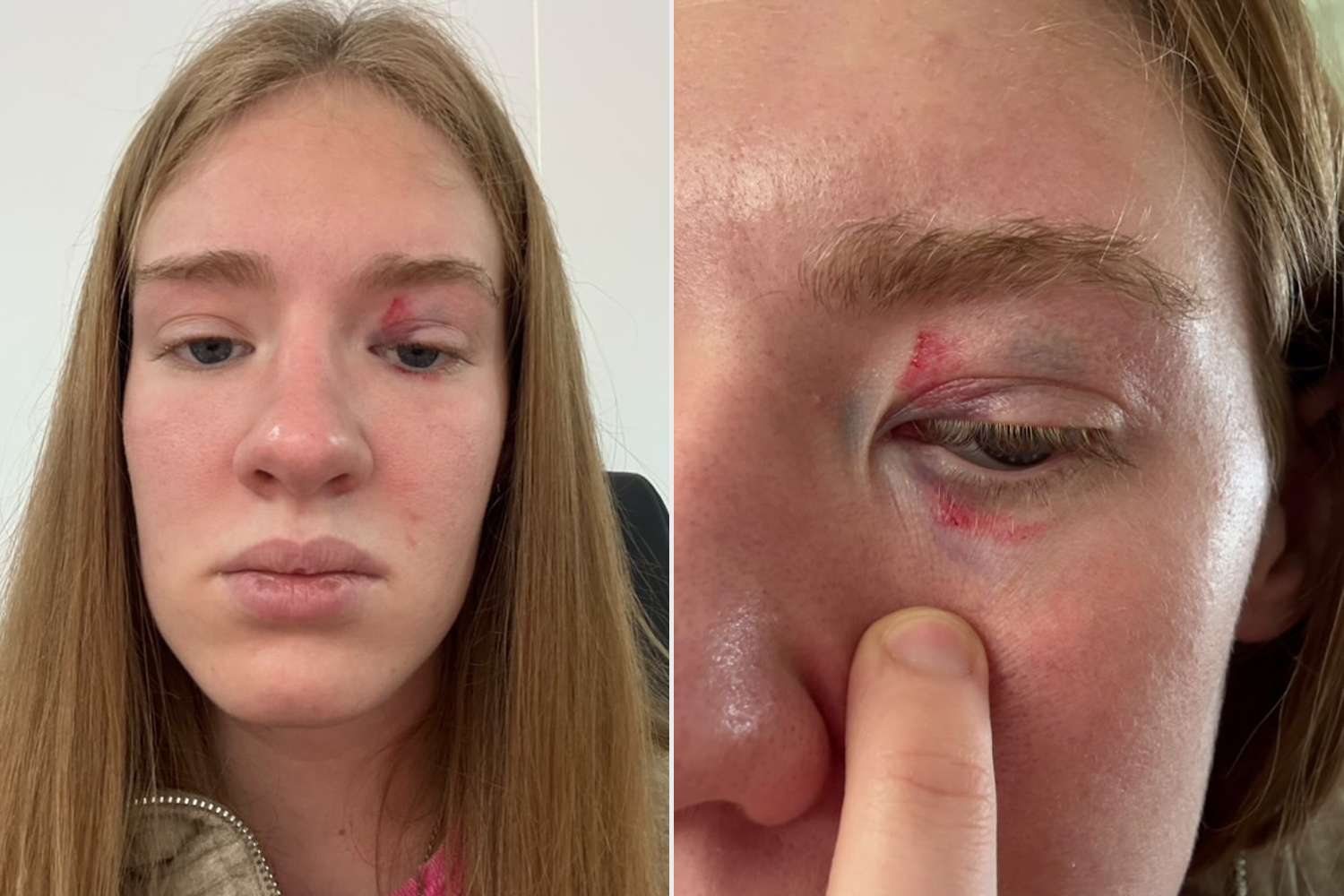 Mermaid Performer Recalls Giant Fish Biting Her Head in Aquarium