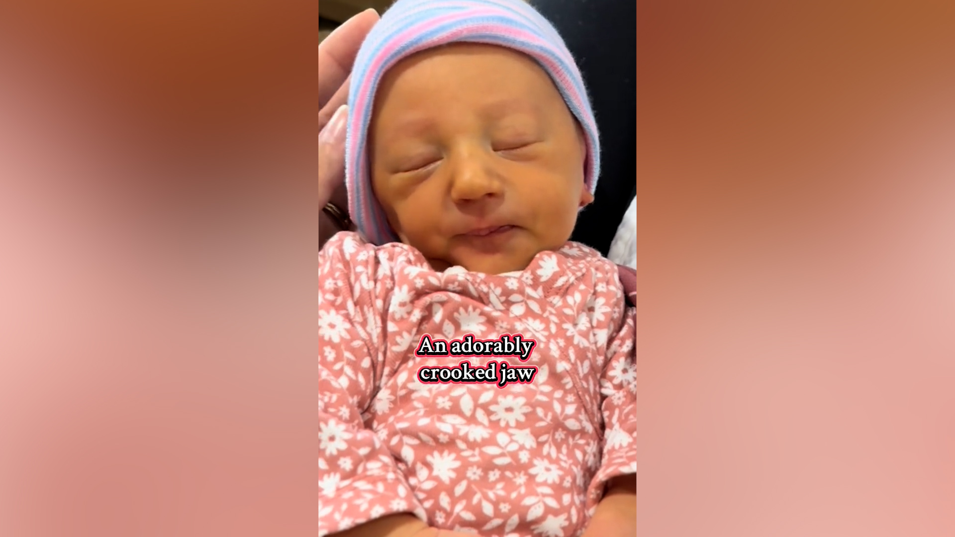 Mom Shares How Twin Got a ‘Crooked Jaw’ in the Womb