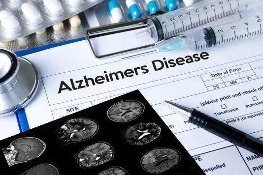 Alzheimer, la frequenza della respirazione a riposo più alta in chi ha la malattia