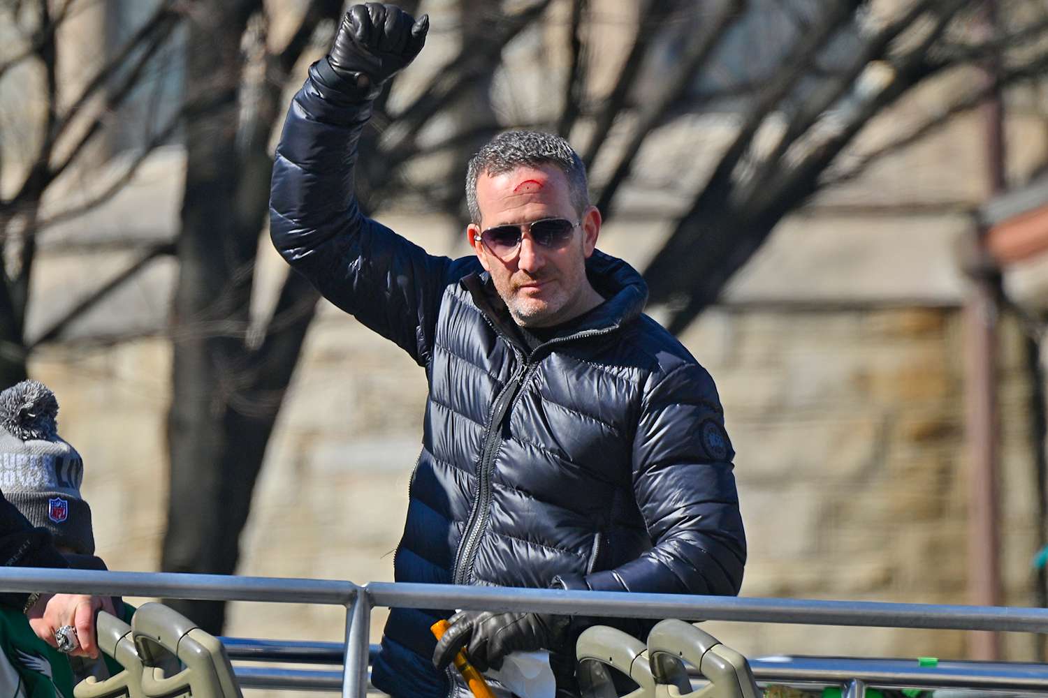 Eagles General Manager Left Bleeding After Getting Hit in Head with(00)