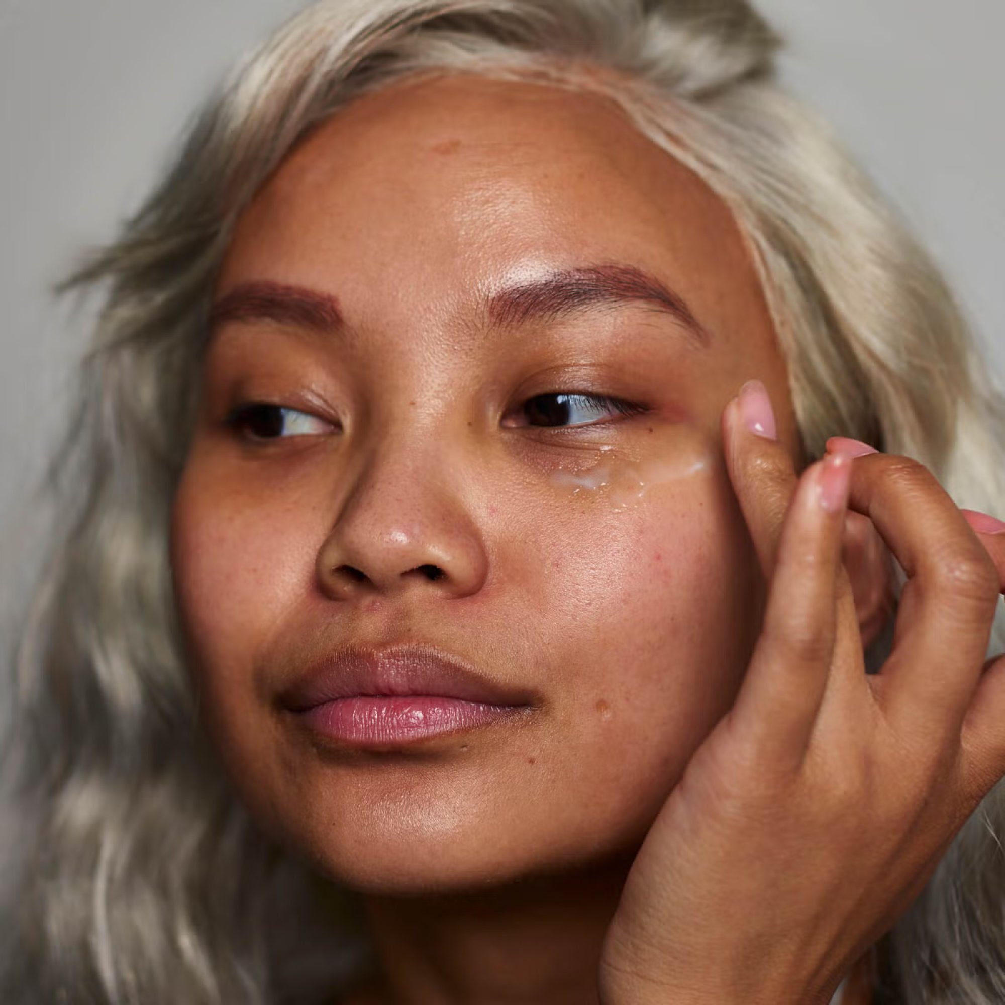 Dark circles and under-eye bags can both be treated. Photo: Handout