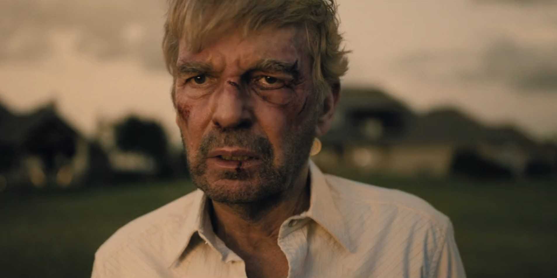 Tommy Norris (Billy Bob Thornton) with his face beaten and bruised looking distraught in Landman season 1, episode 10