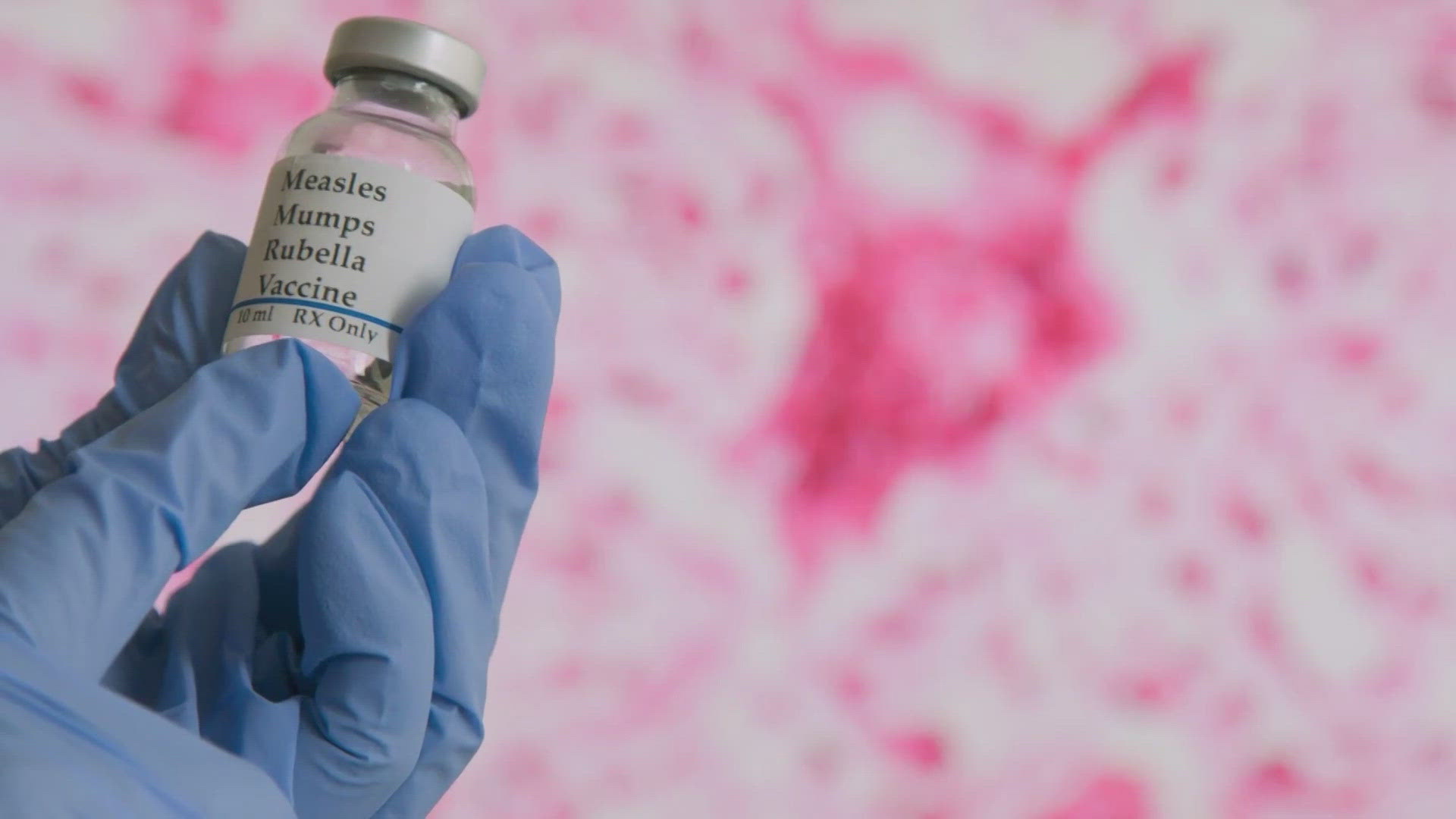 What doctors are saying as measles outbreak expands, how contagious is it?