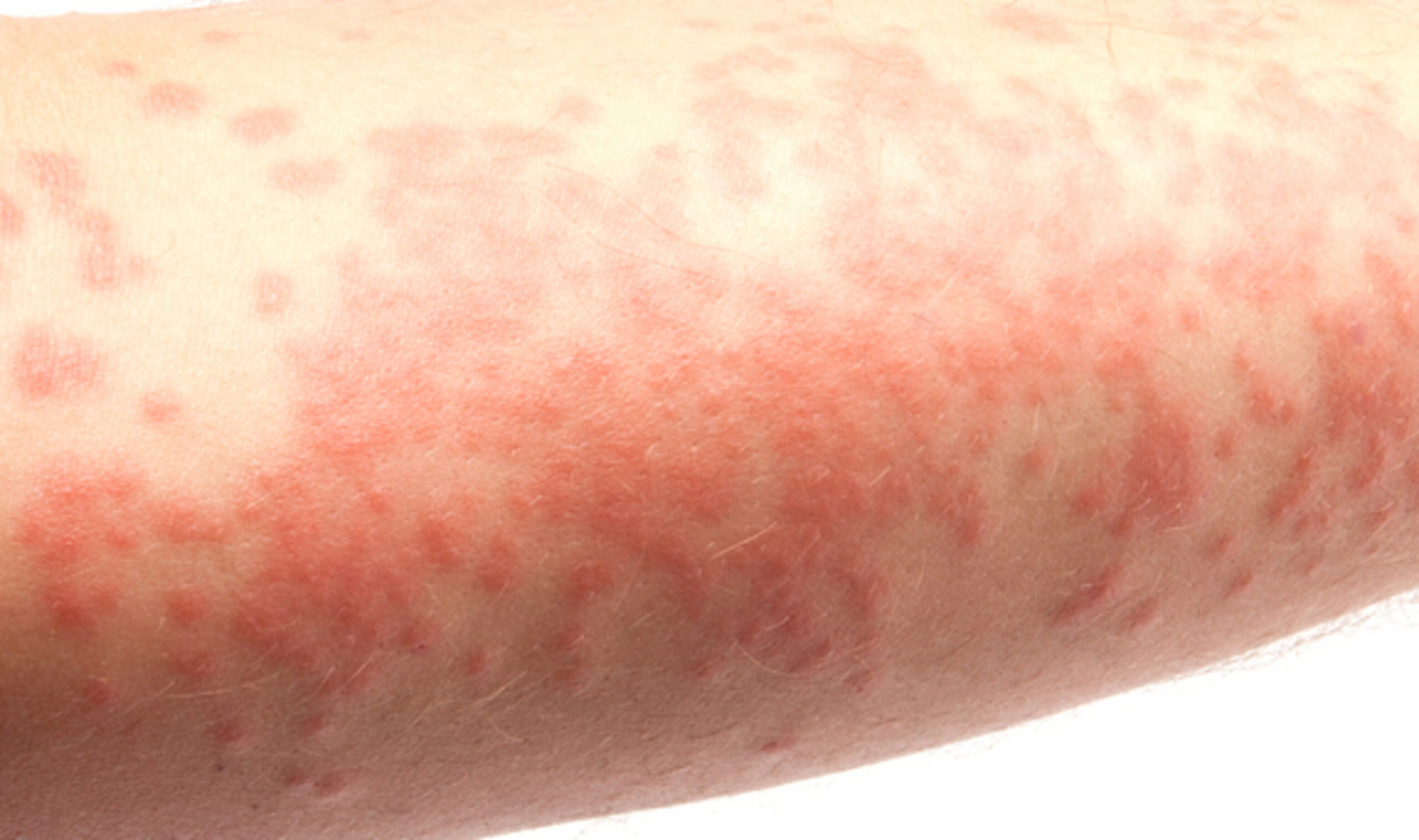 Dr. Jandrei Markus | Palmas-TO (@jandrei_markus) • Instagram photos and  videos, image size:2560x1516