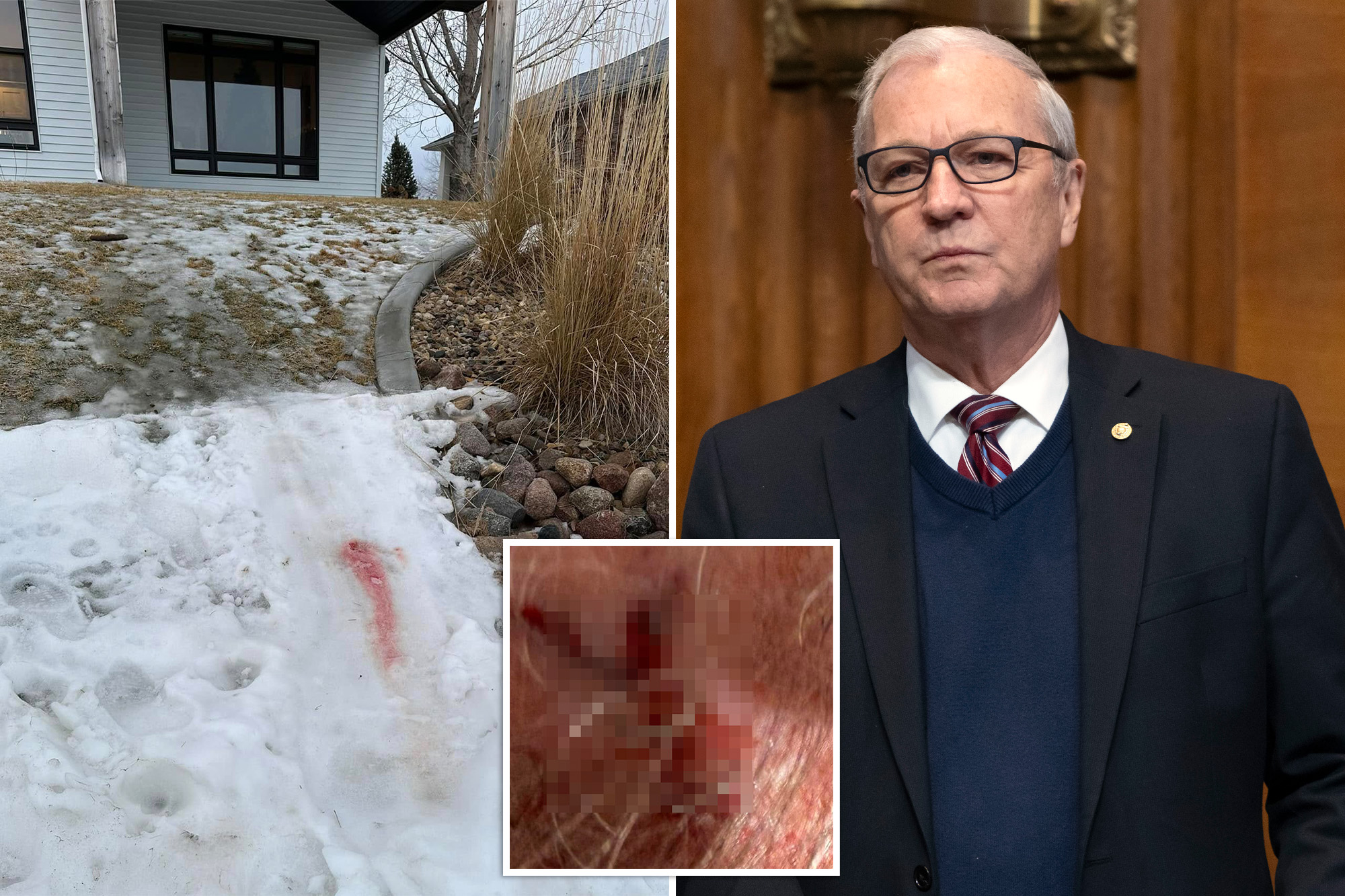 Sen. Kevin Cramer, 64, falls on ice, suffers concussion and ‘slight