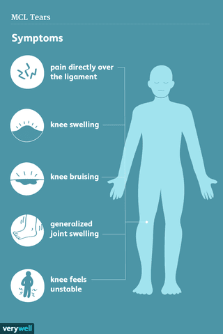 Medial collateral ligament (MCL) tear symptoms and treatment