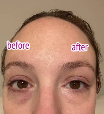 before and after image of reviewer using under eye product