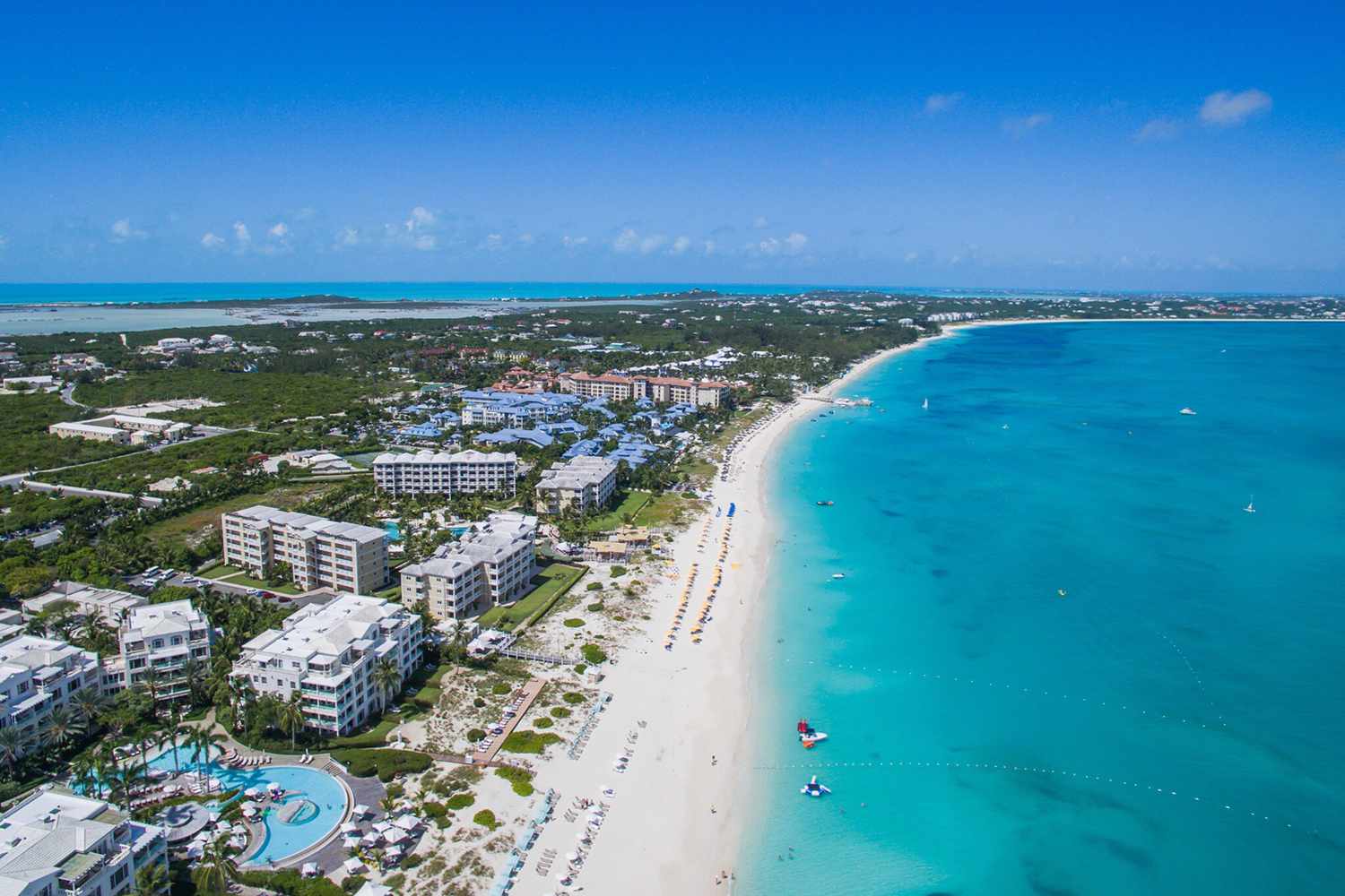 Family of Tourist Who Had Both Hands Bitten Off by a 7Foot Shark(01)