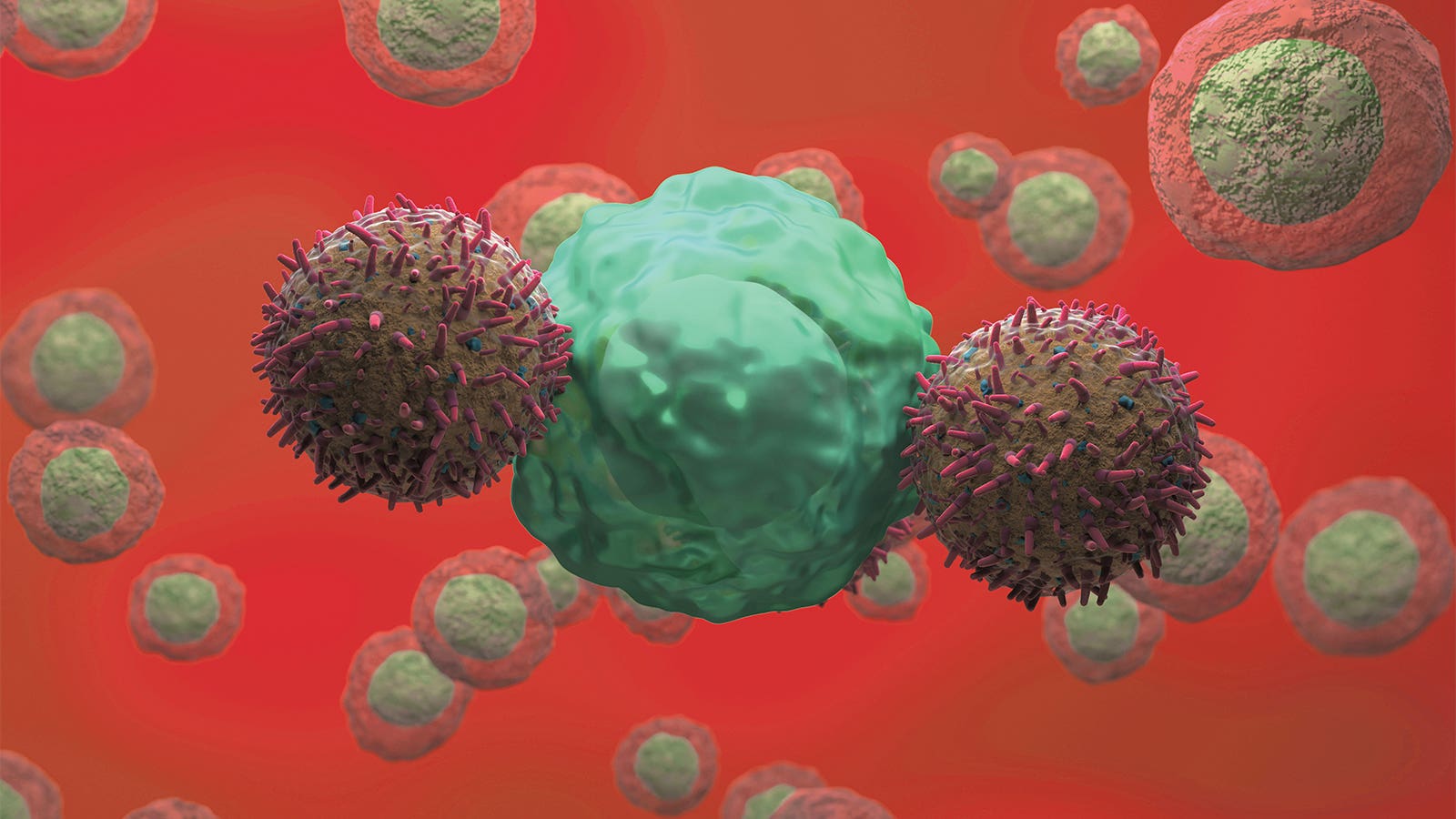 Neuroblastoma Patient Still in Remission 18 Years After CART Infusion