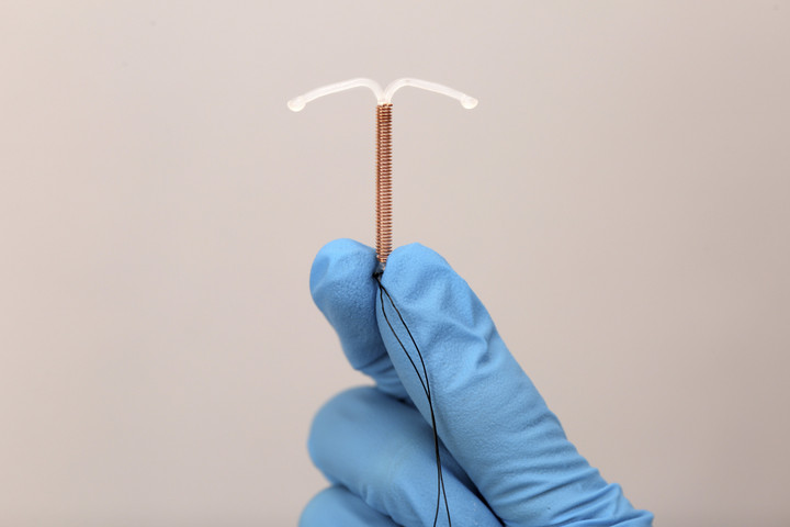 Penyebab IUD Tiba-Tiba Lepas