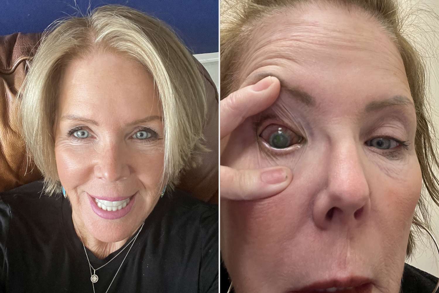 Woman Left Blind from Parasites in Her Eye After Making This Common(01)