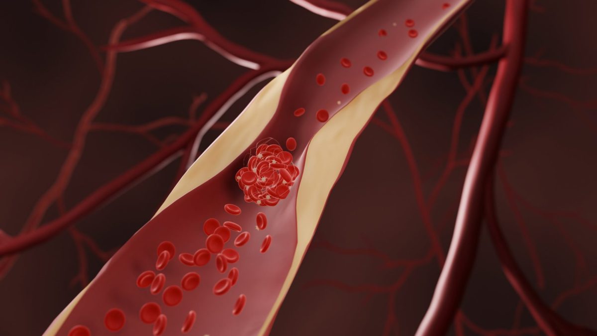 If you have high cholesterol, there are alternatives to statins