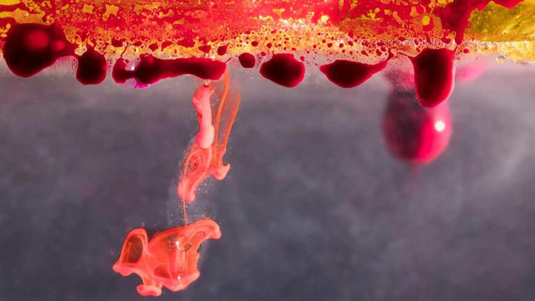 Heavy period clots and pregnancy complications