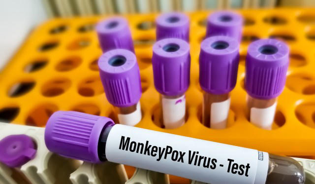 CDC pauses rabies, smallpox testing for state and local public health ...