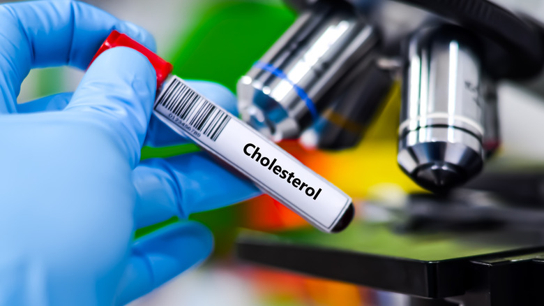 What scientists know about cholesterol that you didn't (until now)