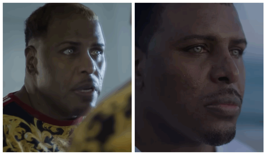 How one Black man’s journey for a new eye color turned into a medical ...