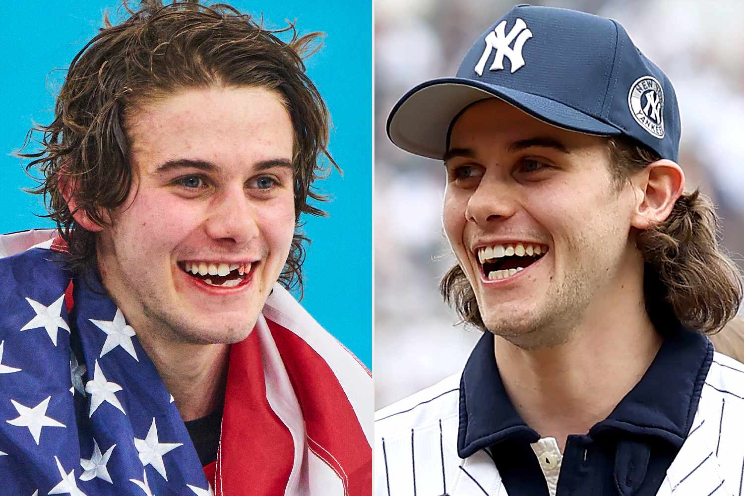 Jack Hughes finally has his teeth fixed after they were broken in ...