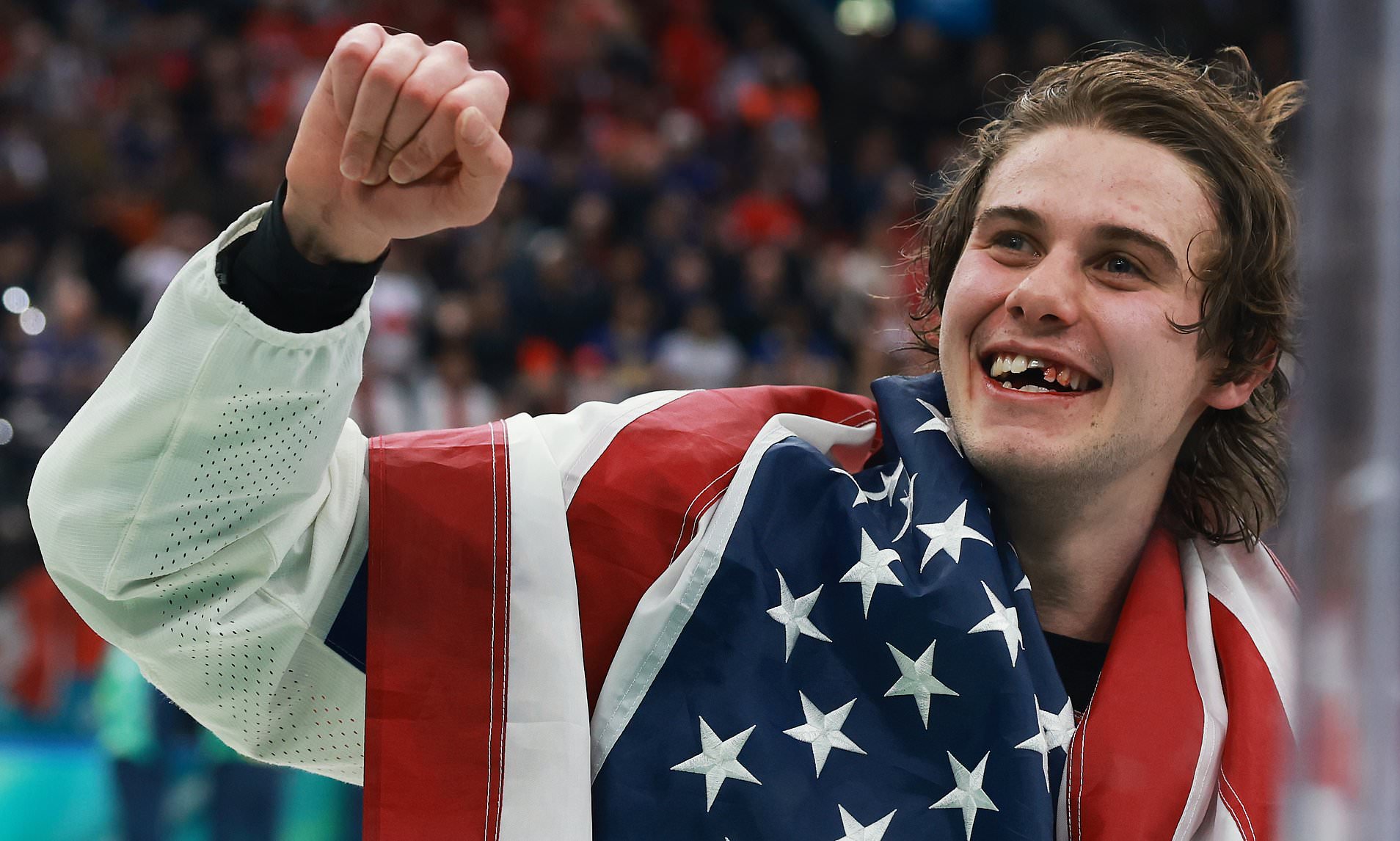 USA hockey hero Jack Hughes shows off new smile after busted teeth in ...