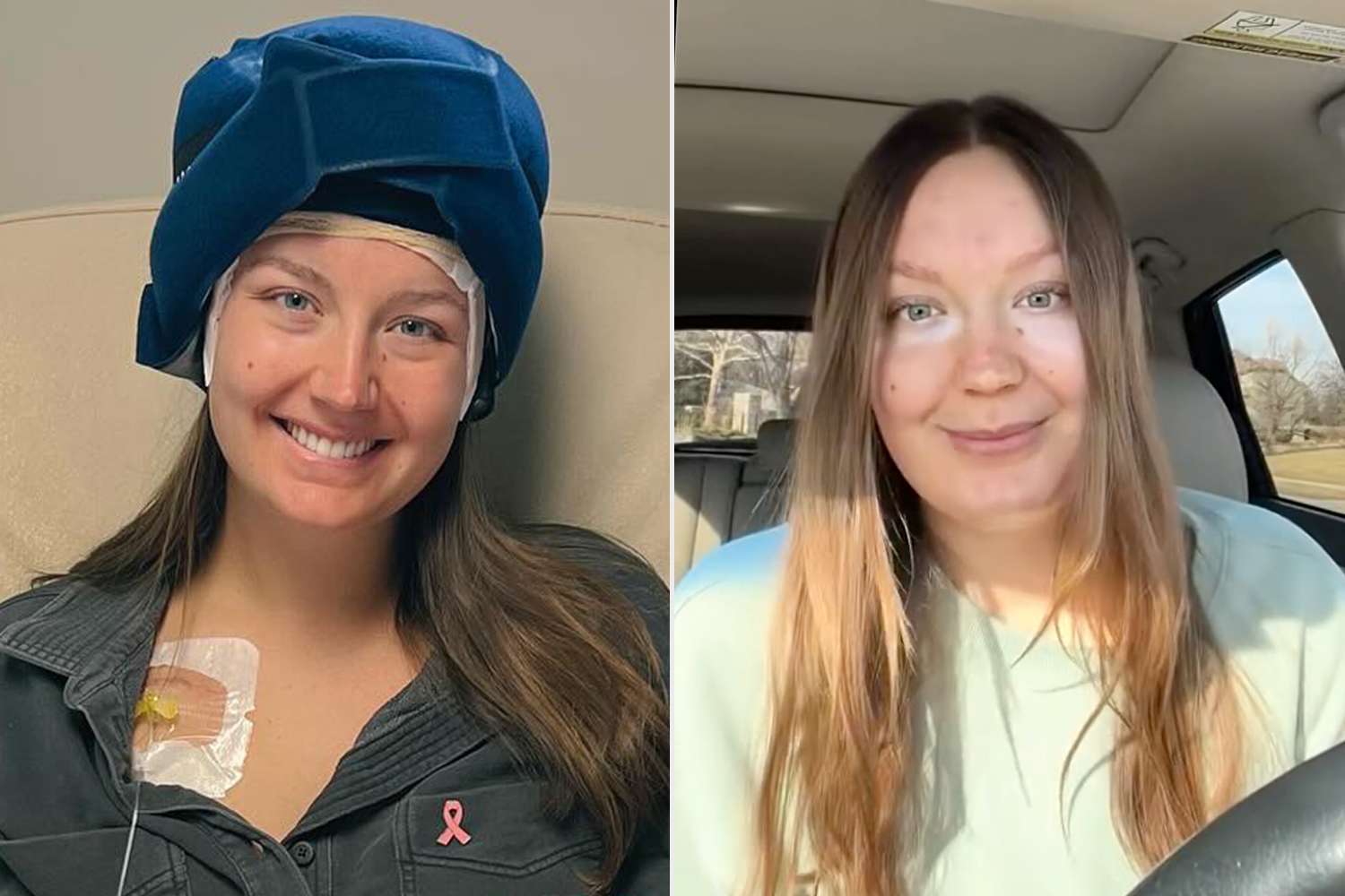 Woman, 24, saves 30% of hair during cancer treatment thanks to husband ...