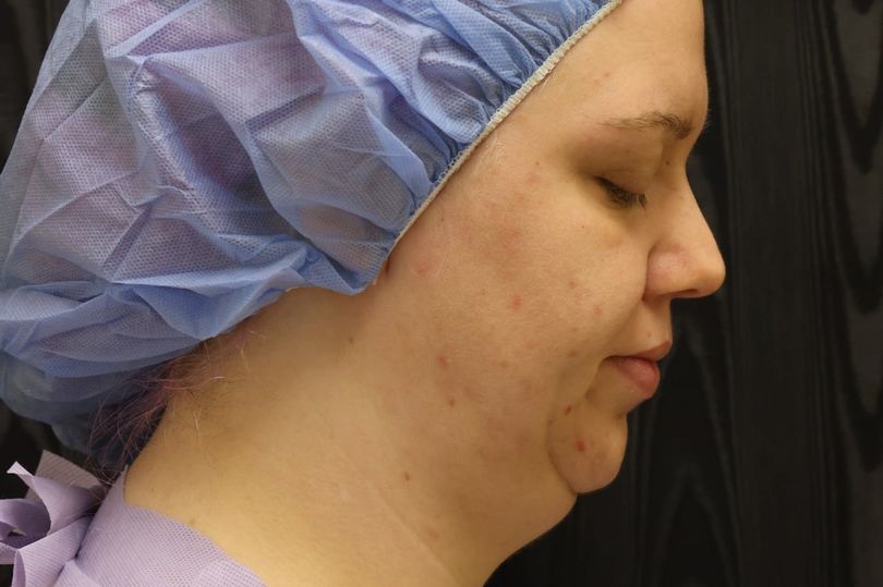 Woman, 31, slammed by online trolls for facelift to banish flabby ...