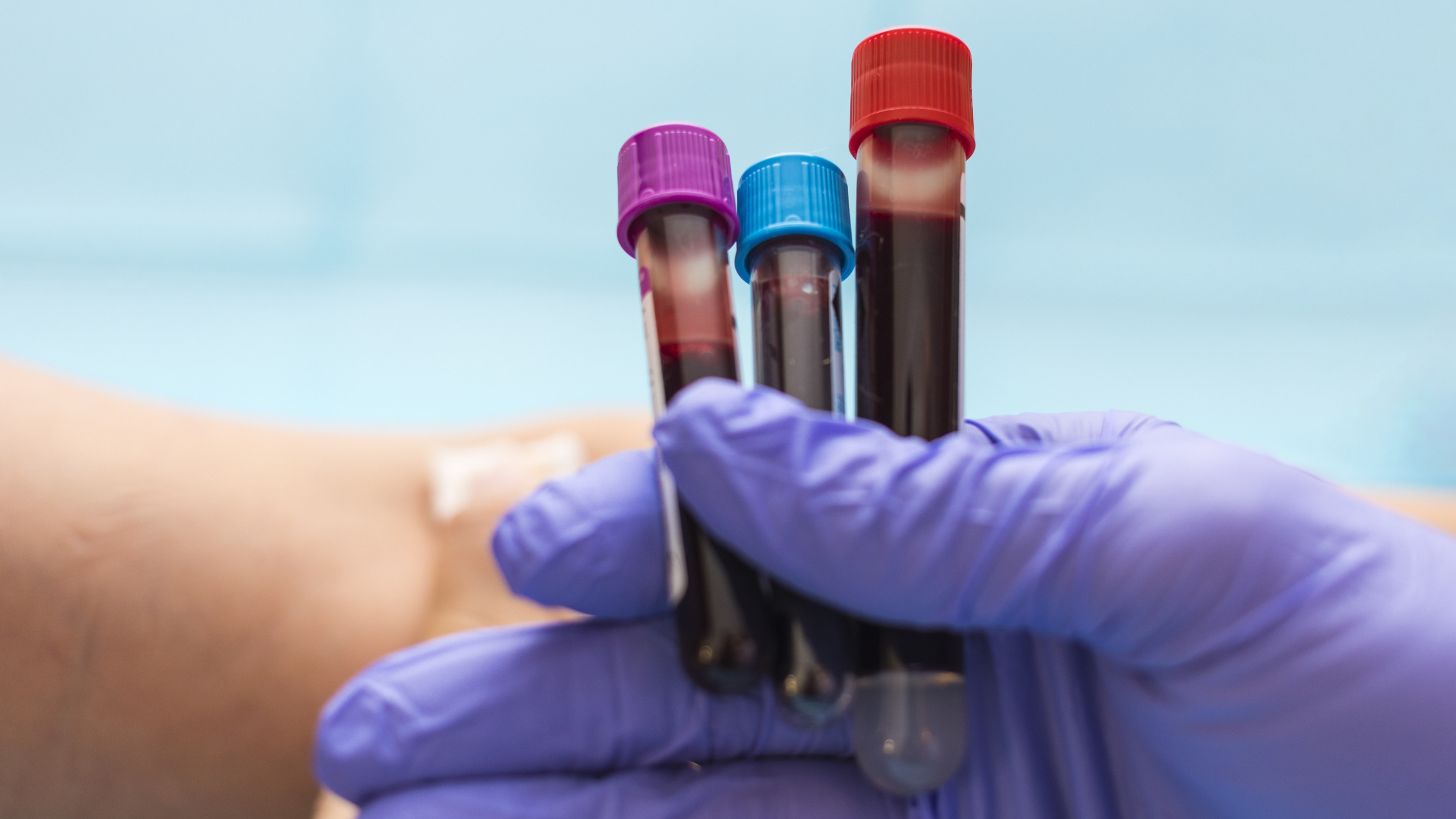 Seniors, here are the top lab tests your doctor might forget