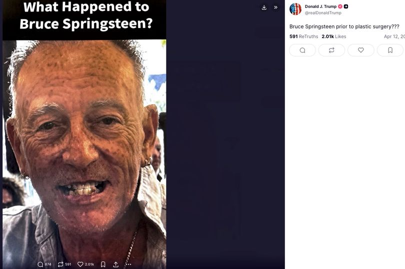 bruce springsteen plastic surgery Image 3