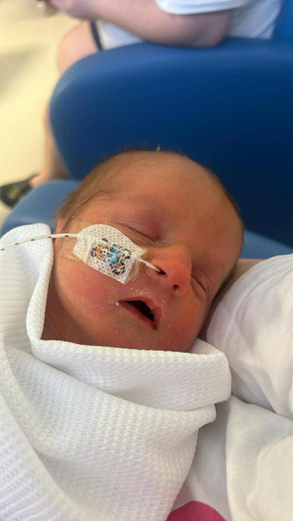 Miracle baby defies ultra-rare genetic condition seen in only 25 people ...