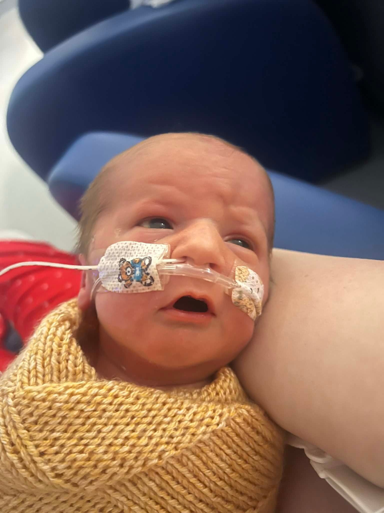 Miracle baby with ultra-rare genetic disorder defies odds