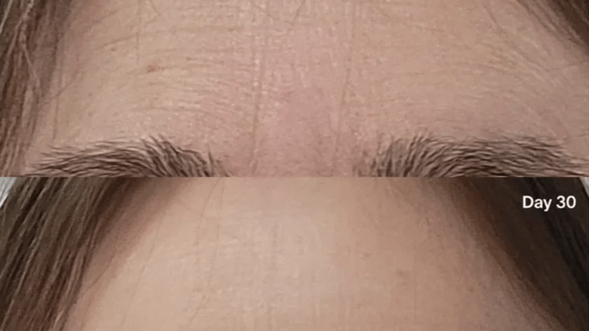 Wrinkles between your brows? This 3-minute fix takes years off