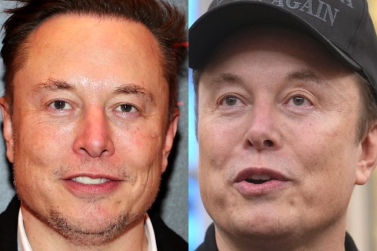 Featured - Elon Musk Plastic Surgery